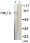 PRKCD / PKC-Delta Antibody (aa471-520)